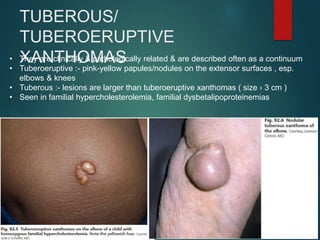 Hyperlipidemias | PPTX