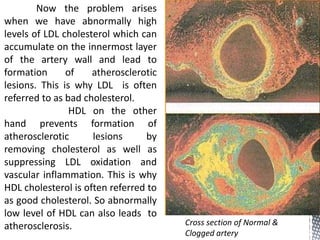 Now the problem arises
when we have abnormally high
levels of LDL cholesterol which can
accumulate on the innermost layer
of the artery wall and lead to
formation of atherosclerotic
lesions. This is why LDL is often
referred to as bad cholesterol.
HDL on the other
hand prevents formation of
atherosclerotic lesions by
removing cholesterol as well as
suppressing LDL oxidation and
vascular inflammation. This is why
HDL cholesterol is often referred to
as good cholesterol. So abnormally
low level of HDL can also leads to
atherosclerosis. Cross section of Normal &
Clogged artery
 
