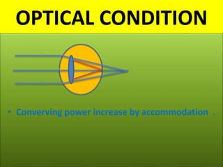 OPTICAL CONDITION
• Converving power increase by accommodation .
 