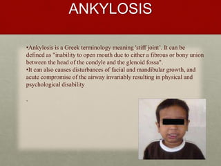 Hypermobility and ankylosis