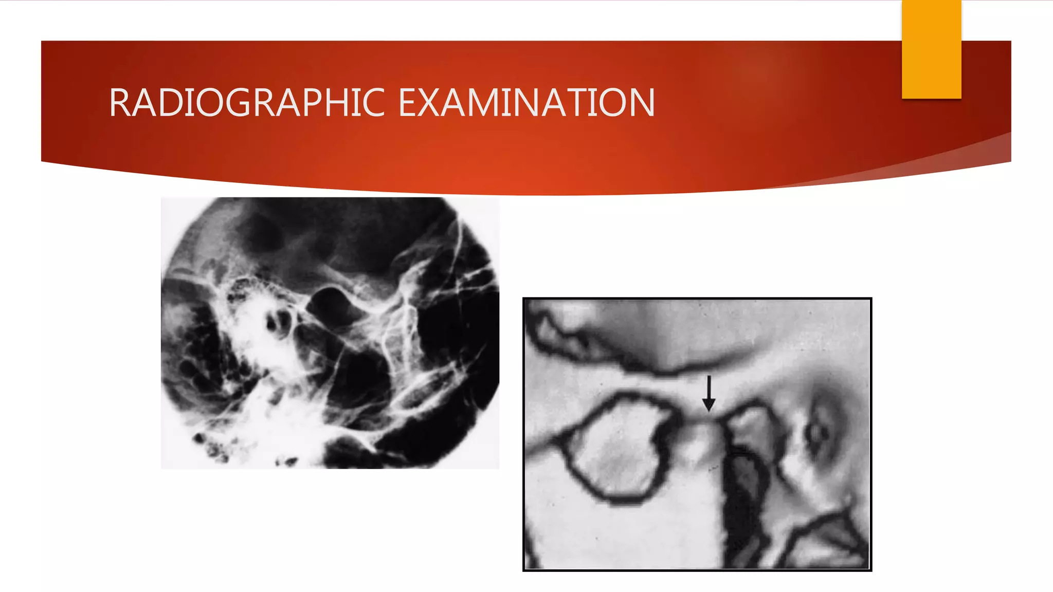 RADIOGRAPHIC EXAMINATION
 