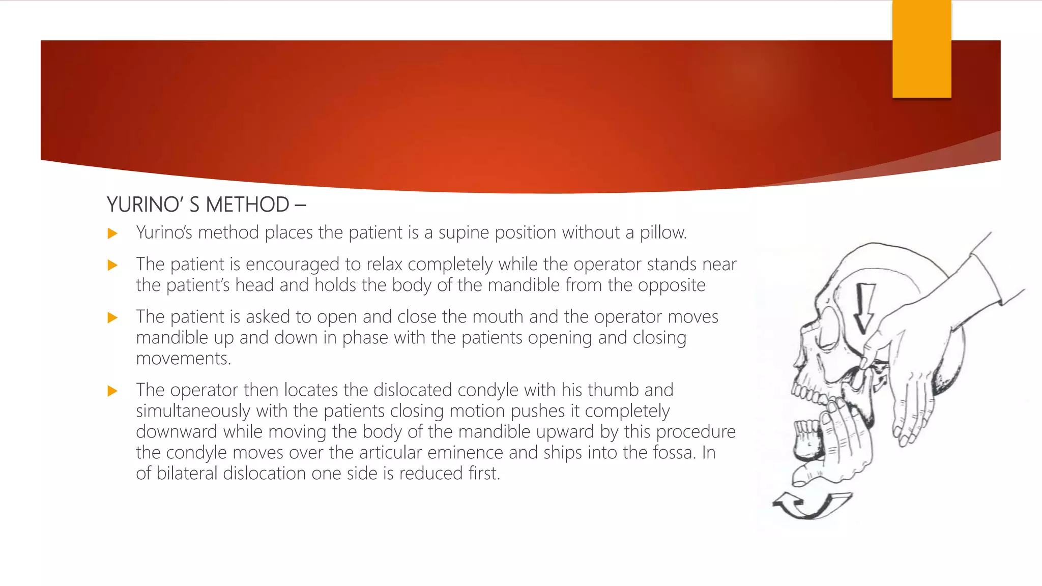 YURINO’ S METHOD –
 Yurino’s method places the patient is a supine position without a pillow.
 The patient is encouraged to relax completely while the operator stands near
the patient’s head and holds the body of the mandible from the opposite
 The patient is asked to open and close the mouth and the operator moves
mandible up and down in phase with the patients opening and closing
movements.
 The operator then locates the dislocated condyle with his thumb and
simultaneously with the patients closing motion pushes it completely
downward while moving the body of the mandible upward by this procedure
the condyle moves over the articular eminence and ships into the fossa. In
of bilateral dislocation one side is reduced first.
 