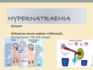 HYPERNATRAEMIA
Qusyairi
Defined as serum sodium >145mmol/L
Normal range: 135-145 mmol/L
 