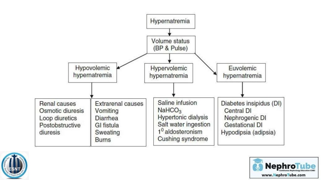 Hypernatremia Stepwise Practical Approach Dr. Gawad