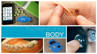 The internet of the
BODY
 