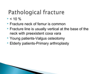  < 10 %
 Fracture neck of femur is common
 Fracture line is usually vertical at the base of the

  neck with preexistent coxa vara
 Young patients-Valgus osteotomy
 Elderly patients-Primary arthroplasty
 