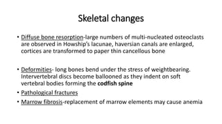 Skeletal changes
• Diffuse bone resorption-large numbers of multi-nucleated osteoclasts
are observed in Howship’s lacunae, haversian canals are enlarged,
cortices are transformed to paper thin cancellous bone
• Deformities- long bones bend under the stress of weightbearing.
Intervertebral discs become ballooned as they indent on soft
vertebral bodies forming the codfish spine
• Pathological fractures
• Marrow fibrosis-replacement of marrow elements may cause anemia
 