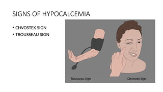 SIGNS OF HYPOCALCEMIA
• CHVOSTEK SIGN
• TROUSSEAU SIGN
 