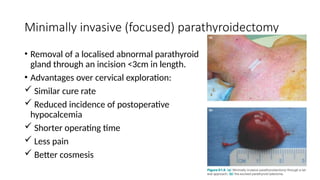 Parathyroid Incision Comprehensive Overview of Hyperparathyroidism: Clinical Features and ...