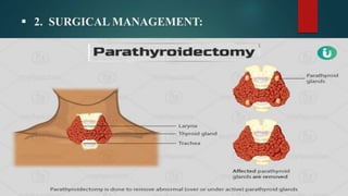  2. SURGICAL MANAGEMENT:
 