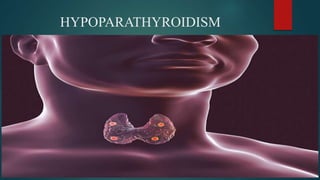 HYPOPARATHYROIDISM
 