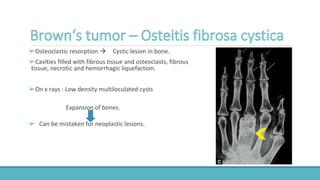 ➢Osteoclastic resorption  Cystic lesion in bone.
➢Cavities filled with fibrous tissue and osteoclasts, fibrous
tissue, necrotic and hemorrhagic liquefaction.
➢On x rays : Low density multiloculated cysts
Expansion of bones.
➢ Can be mistaken for neoplastic lesions.
 