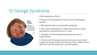 ➢Microdeletion at 22q11.
➢Failure of the development of the 3rd & 4th pharyngeal
pouches
➢Affecting the thymus and parathyroid glands.
➢ Poor thymic development abnormal immune system
development and deficiencies in T-cells.
➢ Improper parathyroid gland development leads to
hypocalcemia.
➢ Patients with DiGeorge Syndrome can also present with
congenital cardiac defects (particularly of the outflow tracts),
abnormal facial development, and cleft palates
 