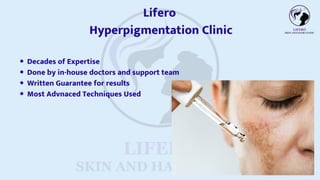 Decades of Expertise
Done by in-house doctors and support team
Written Guarantee for results
Most Advnaced Techniques Used
Lifero
Hyperpigmentation Clinic
 