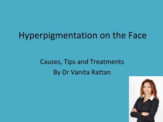 Hyperpigmentation on the Face
Causes, Tips and Treatments
By Dr Vanita Rattan
 
