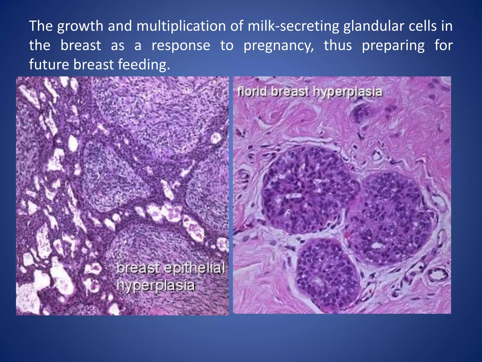 Hyperplasia | PPTX | Endocrine and Metabolic Diseases | Diseases and ...