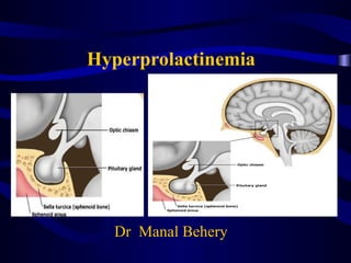 Hyperprolactinemia
Dr Manal Behery
 