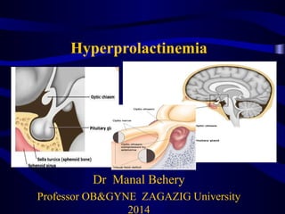 Hyperprolactinemia
Dr Manal Behery
Professor OB&GYNE ZAGAZIG University
2014
 