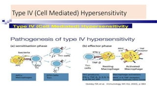 Type IV (Cell Mediated) Hypersensitivity
 