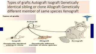 Types of grafts Autograft Isograft Genetically
identical sibling or clone Allograft Genetically
different member of same species Xenograft
 