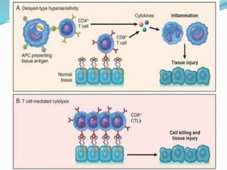 Comprehensive Overview of Hypersensitivity and Autoimmune Disorders in ...