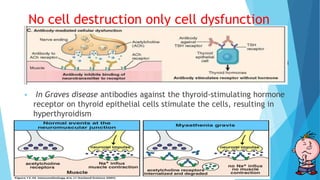 No cell destruction only cell dysfunction
 Antibody directed against cell surface receptors impair or dysregulate
function without causing cell injury or inflammation
 Myasthenia gravis, antibodies reactive with acetylcholine receptors in
the motor end plates of skeletal muscles block neuromuscular
transmission and therefore cause muscle weakness.
 In Graves disease antibodies against the thyroid-stimulating hormone
receptor on thyroid epithelial cells stimulate the cells, resulting in
hyperthyroidism
 