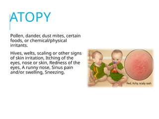 hypersensitivity reaction , type and future | PPTX