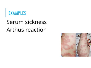 hypersensitivity reaction , type and future | PPTX