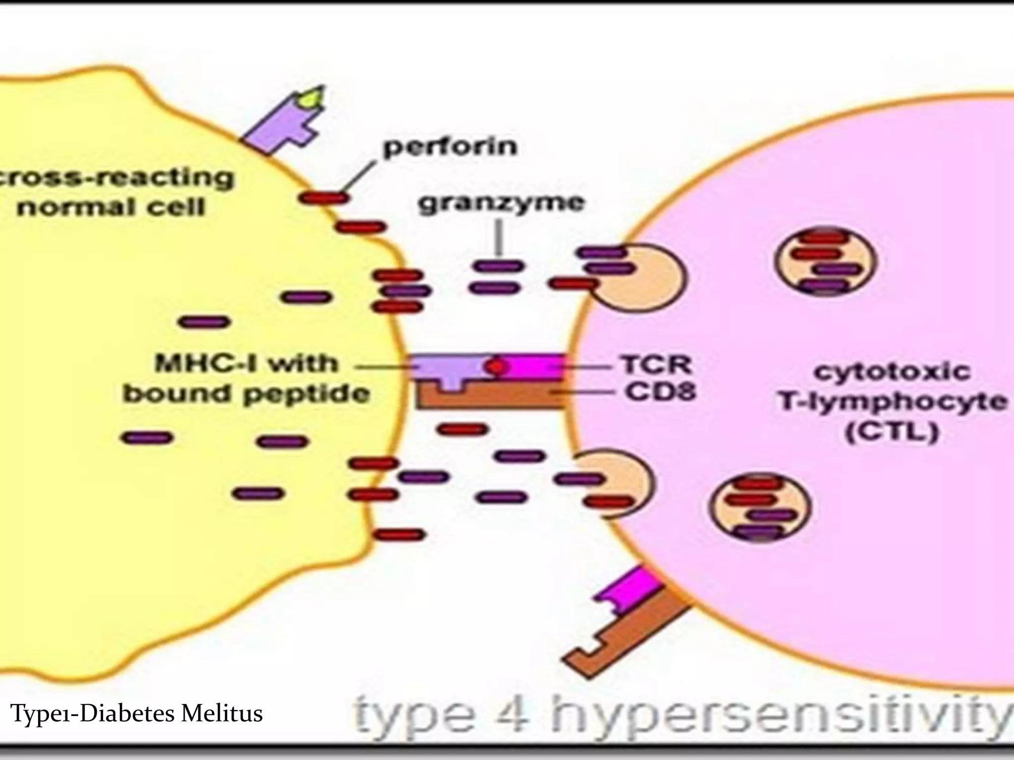 Hypersensitivity Ppt