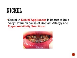 ▪Nickel in Dental Appliances is known to be a
Very Common cause of Contact Allergy and
Hypersensitivity Reactions.
 