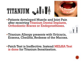 ▪Patients developed Muscle and Joint Pain
after receiving Titanium Dental Implants,
Orthodontic Braces or Endoprostheses.
▪Titanium Allergy presents with Urticaria,
Eczema, Cheilitis, Redness of the Mucosa.
▪Patch Test is Ineffective. Instead MELISA Test
is done for Titanium Sensitisation.
 