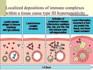 Localized depositions of immune complexes
within a tissue cause type III hypersensitivity
 