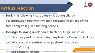 Hypersensitivity.pptxHypersensitivity.pptx