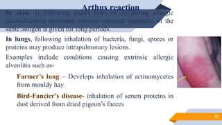 Hypersensitivity REACTIONS 1 TO 4 BY ARUN. | PPTX