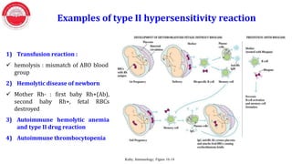 Examples of type II hypersensitivity reaction
1) Transfusion reaction :
 hemolysis : mismatch of ABO blood
group
2) Hemolytic disease of newborn
 Mother Rh- : first baby Rh+(Ab),
second baby Rh+, fetal RBCs
destroyed
3) Autoimmune hemolytic anemia
and type II drug reaction
4) Autoimmune thrombocytopenia
Kuby; Immunology; Figure 16-14
 