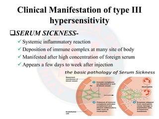 Hypersensitivity (Allergy) - Drug allergy, Contact dermatitis, Allergic ...