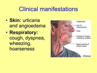 Clinical manifestations Skin:  urticaria and angioedema Respiratory:  cough, dyspnea, wheezing, hoarseness 
