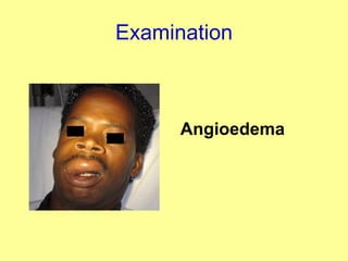 Examination Angioedema 