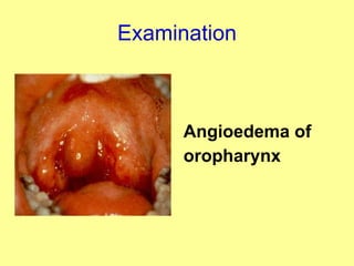 Examination Angioedema of oropharynx 