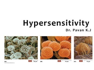 Hypersensitivity
Dr. Pavan K.J
 