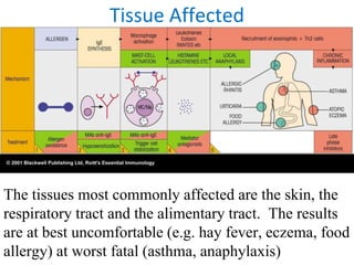 Tissue Affected
The tissues most commonly affected are the skin, the
respiratory tract and the alimentary tract. The results
are at best uncomfortable (e.g. hay fever, eczema, food
allergy) at worst fatal (asthma, anaphylaxis)
 