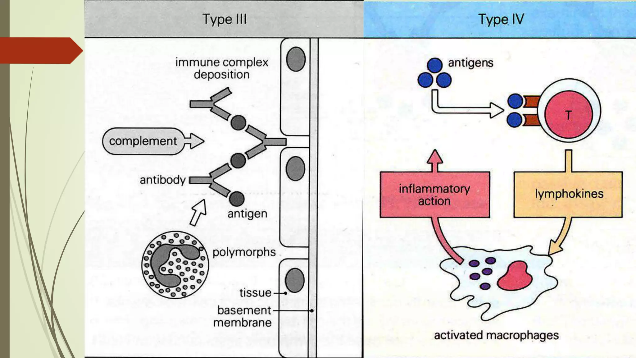 Hypersensitivity & its classification by suman bhattarai