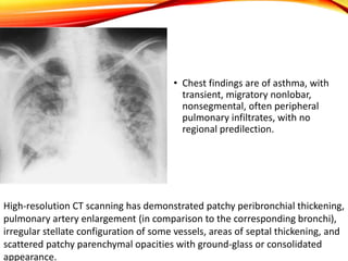 • Chest findings are of asthma, with
transient, migratory nonlobar,
nonsegmental, often peripheral
pulmonary infiltrates, with no
regional predilection.
High-resolution CT scanning has demonstrated patchy peribronchial thickening,
pulmonary artery enlargement (in comparison to the corresponding bronchi),
irregular stellate configuration of some vessels, areas of septal thickening, and
scattered patchy parenchymal opacities with ground-glass or consolidated
appearance.
 