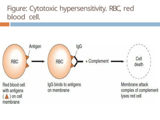 Figure: Cytotoxic hypersensitivity. RBC, red
blood cell.
 