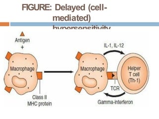 FIGURE: Delayed (cell-
mediated)
hypersensitivity
 