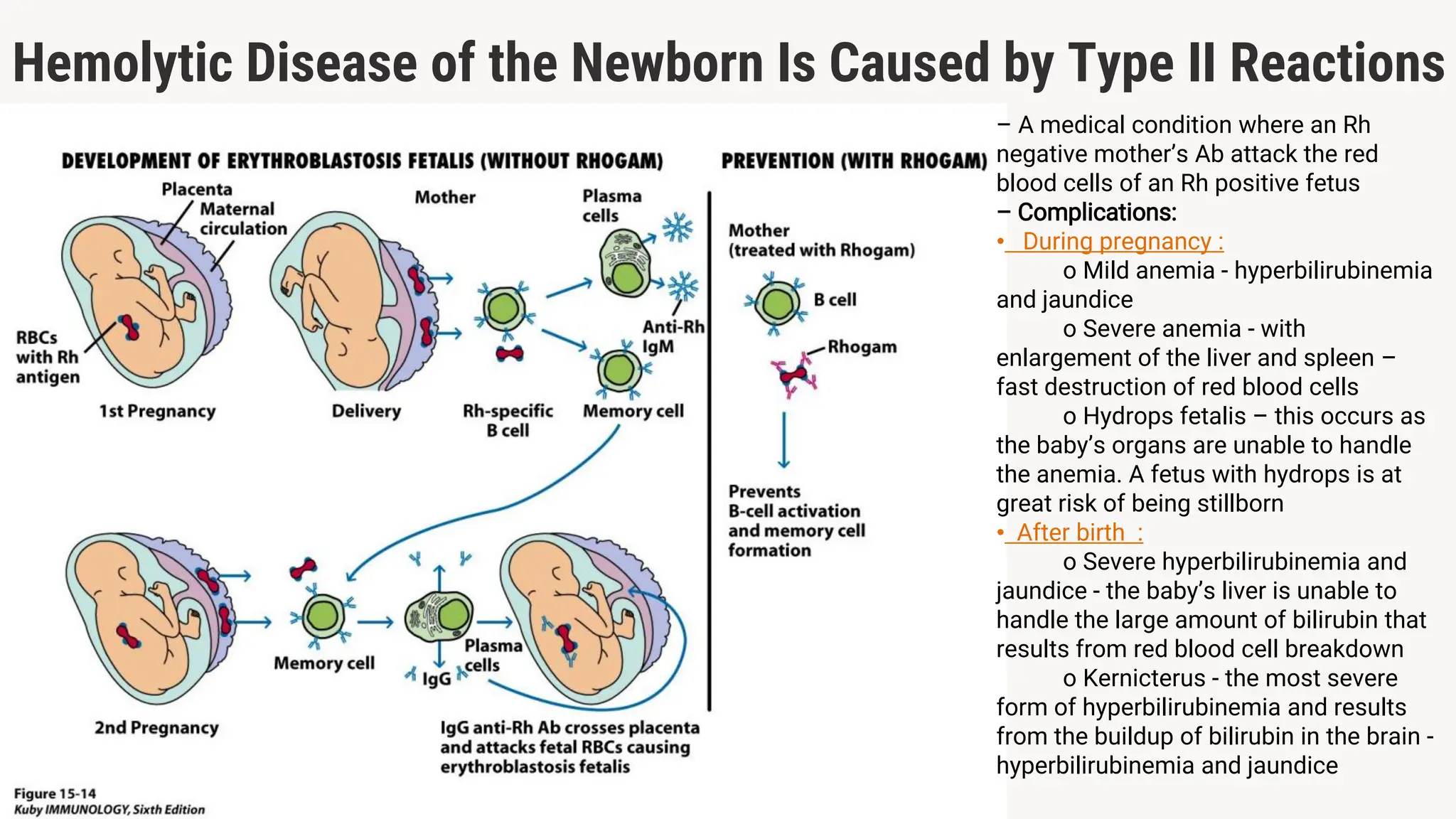Hemolytic Disease of the Newborn Is Caused by Type II Reactions
– A medical condition where an Rh
negative mother’s Ab attack the red
blood cells of an Rh positive fetus
– Complications:
• During pregnancy :
o Mild anemia - hyperbilirubinemia
and jaundice
o Severe anemia - with
enlargement of the liver and spleen –
fast destruction of red blood cells
o Hydrops fetalis – this occurs as
the baby’s organs are unable to handle
the anemia. A fetus with hydrops is at
great risk of being stillborn
• After birth :
o Severe hyperbilirubinemia and
jaundice - the baby’s liver is unable to
handle the large amount of bilirubin that
results from red blood cell breakdown
o Kernicterus - the most severe
form of hyperbilirubinemia and results
from the buildup of bilirubin in the brain -
hyperbilirubinemia and jaundice
 