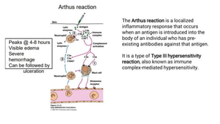 The Arthus reaction is a localized
inflammatory response that occurs
when an antigen is introduced into the
body of an individual who has pre-
existing antibodies against that antigen.
It is a type of Type III hypersensitivity
reaction, also known as immune
complex-mediated hypersensitivity.
 