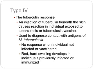 Type IV
 The tuberculin response
 An injection of tuberculin beneath the skin
causes reaction in individual exposed to
tuberculosis or tuberculosis vaccine
 Used to diagnose contact with antigens of
M. tuberculosis
 No response when individual not
infected or vaccinated
 Red, hard swelling develops in
individuals previously infected or
immunized
 