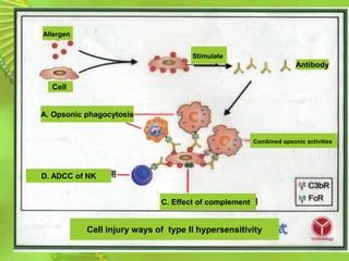 Allergen
Stimulate
Antibody
A. Opsonic phagocytosis
D. ADCC of NK
C. Effect of complement
Combined opsonic activities
Cell injury ways of type II hypersensitivity
Cell
 