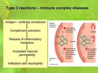 Type 3 reactions – immune complex diseases
Antigen – antibody complexes
Complement activation
Release of inflammatory
mediators
Increased vascular
permeability
Infiltration with neutrophils
 